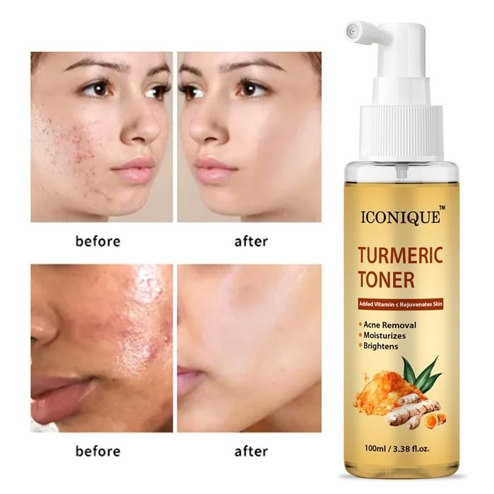 Turmeric Toner 100ML h5swdg-k7