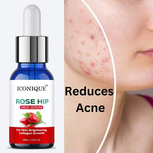 Rose Hip Face Serum 30ML h5swdg-k7